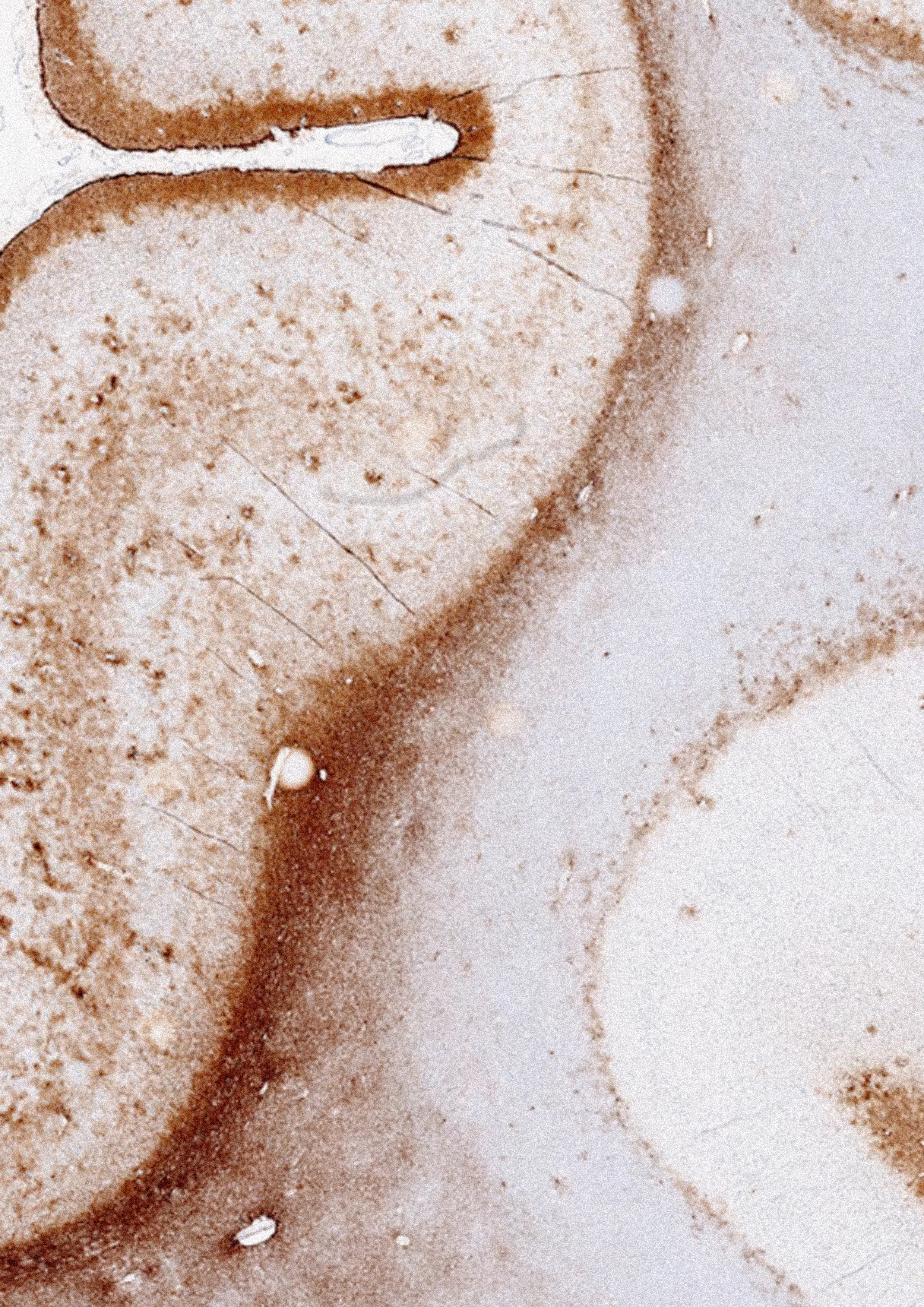 Militarismo y Capital: los gastos militares y la necesidad imperialista del capitalismo